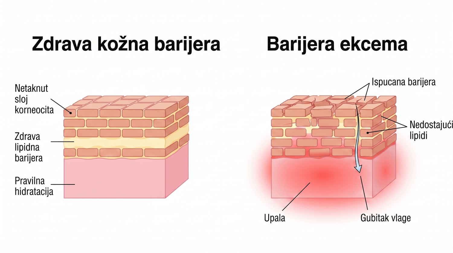 eczema_HR_skin_barrier_v2.png