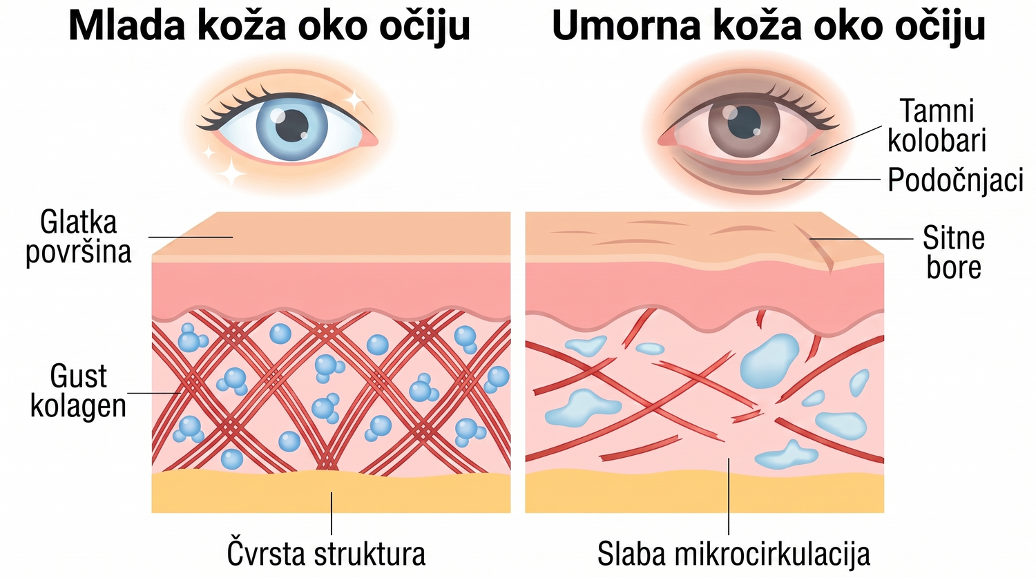 Rose Eye Lift HR eyev1
