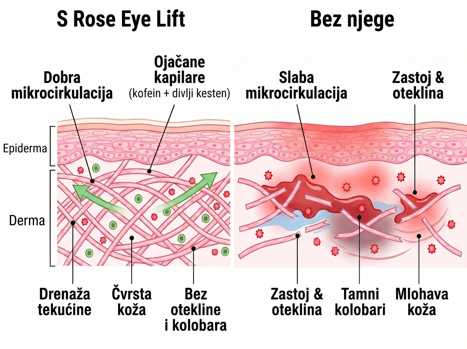 Rose Eye Lift HR t17